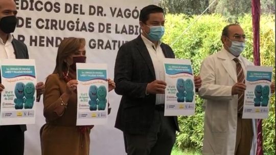 Al menos12 niños con labio leporino y paladar hendido serán operados por día en jornada de Gobierno estatal