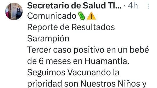 Ya son 3 casos de sarampión en Tlaxcala, se extiende ahora a un bebé en Huamantla